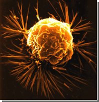 Медицина та нанотехнології: Ракові клітини тепер будуть ... підривати! 