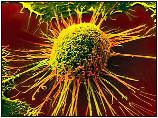 Обнаружен новый метод борьбы с раковыми клетками
