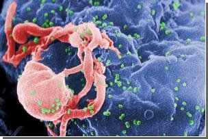 Ученые нашли ген, блокирующий распространение ВИЧ