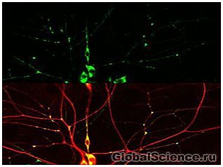 Обнаружен белок, который помогает восстанавливаться нервным клеткам