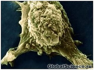 Блокировка энзима тормозит распространение рака в организме