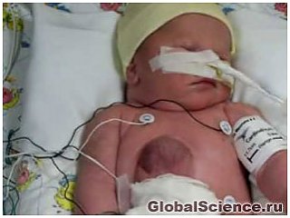 В Китае родился младенец с сердцем снаружи