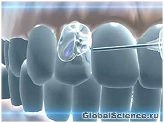 Ученые создали новый антибактериальный материал для пломбирования зубов