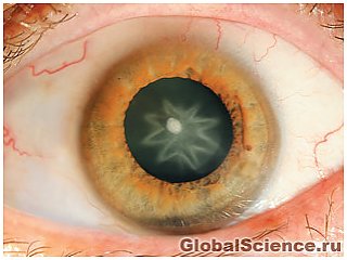 Необычная катаракта появилась в глазу австрийца после удара