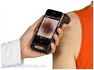 При помощи устройства iPhone можно будет выявлять рак кожи