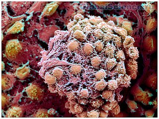 Учеными обнаружена связь между раком и стволовыми клетками