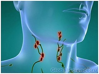 Предположение врачей о болезни лимфоузлах на шее