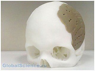 Использование 3D принтеров в медицине