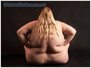 Ожирение — проблема современного общества