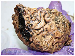 При раскопках в обнаруженном древнем черепе оказался мозг