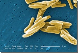 У туберкулеза более древние корни, считают ученые