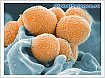 Учёные объяснили рост тяжёлых инфекций, вызываемых Streptococcus